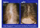 Supporting Hair Regrowth After Chemotherapy with Care and Comfort