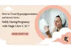 How to Treat Hyperpigmentation and Stretch Marks Safely During Pregnancy with Magic Glow UAE