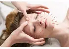 Acupuncture Treatment Thornhill: Awakens Inner Healing Energy at Midori Day Spa