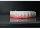 Full Mouth Dental Implants in Mexico with Teeth Savers