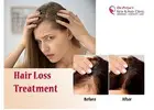 Best Hair Loss Treatment Clinics in Bangalore: Get Results Now!