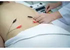 Bryant Park Acupuncture & Holistic Wellness in Midtown NYC