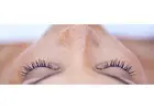 Laser treatment for face pigmentation