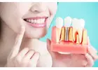 Teeth Cleaning in Buckhead