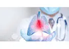 Expert Care for Lung Cancer Singapore Patients