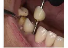 Holistic Dentist in Mexico – Natural, Biocompatible Care for Your Health and Smile
