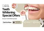 Bright Smiles with Expert Teeth Whitening in Newark