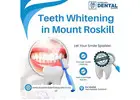 Teeth Whitening in Mount Roskill