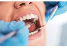 Get the Smile You Deserve with Expert Veneers in Georgetown