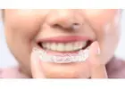 Affordable Braces Singapore – Straighten Your Smile with Expert Care