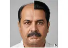 Trusted Hair Wig Shop in Delhi – 10+ Years Experience
