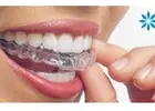 Teeth Whitening Service In Huntington Beach