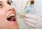 Root Canal Treatment in Mount Roskill