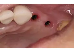 Get Your Perfect Smile by Treating from Dentist in Tijuana Get Your Perfect Smile by Treating from Dentist in Tijuana