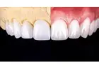 Revive your natural and flawless smiles with holistic Dental care in Tijuana