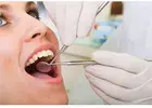 Root Canal Treatment in Mount Roskill, Auckland