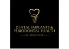 Dental Implants & Periodontal Health
