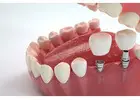 Dental Implants in Northeast Philadelphia for Long Lasting Natural Looking Smiles