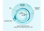 ICSI Treatment in Delhi - Dr Rhythm Gupta