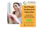 Specialized Acne Clinic In Hyderabad | Dr. Venus