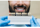 Bring back your true smile with our treatment of root canal in Tijuana