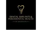 Dental Implants & Periodontal Health
