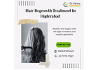 Hair Regrowth Treatment In Hyderabad | Dr. Venus