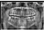 Transform your smile and appeal with steadfast Cosmetic dentist in Tijuana