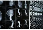Heart ultrasound Craigieburn