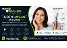 Advanced Tooth Implant in Surat for a Confident Smile