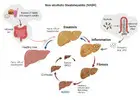 Research Team Supports Diabetes Mellitus Studies with Advanced Laboratory Services
