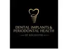 Dental Implants & Periodontal Health