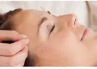 Holistic Skin Rejuvenation: Facial Acupuncture & Microneedling in NYC