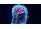 Brain Hemorrhage Operation – Advanced Treatment | IRFacilities