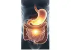 Expert Gastrointestinal Cancer Surgery in Delhi
