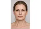 Skin Tightening Treatment in Delhi – Get Firmer, Younger-Looking Skin