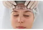 Thread Facelift Treatment in Kolkata Advanced Care