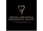 Dental Implants & Periodontal Health