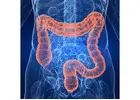 Colorectal Surgery in Delhi – Advanced Treatment for Piles, Fissures, Fistula & Colon Disorders