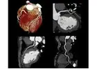 Cardiologist Wallan