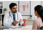 Best Doctor for Fibroid Treatment in Chennai | Specialist