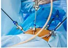 Laparoscopy for Infertility in Delhi - Dr Rhythm Gupta