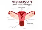 Hysteroscopy Procedure in Delhi - Dr Rhythm Gupta
