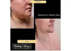 Best Breast Augmentation Alameda
