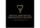 Dental Implants & Periodontal Health