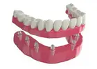 Comfortable Dentures in Bristol PA for a Natural Looking Confident and Healthy Smile