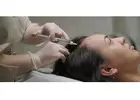 Best PRP Hair Treatment in Mumbai Dermaprocenter Experts