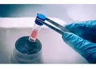 Fertility Preservation in Delhi - Dr Rhythm Gupta