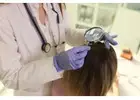 Exosome Treatment for Hair Loss for Effective Regrowth