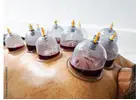 Cupping Therapy NYC | Expert Cupping Services in New York City